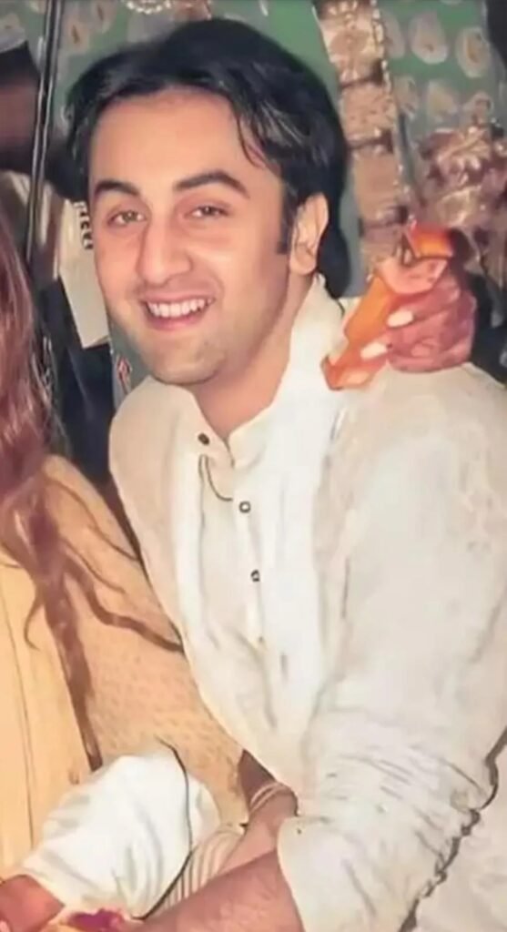 Ranbir Kapoor Hair Loss